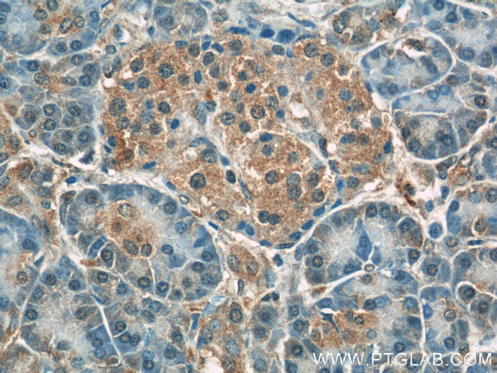 Immunohistochemistry (IHC) staining of human pancreas tissue using Radixin Polyclonal antibody (13790-1-AP)