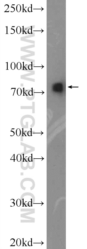 Western Blot (WB) analysis of HEK-293 cells using Radixin Polyclonal antibody (13790-1-AP)