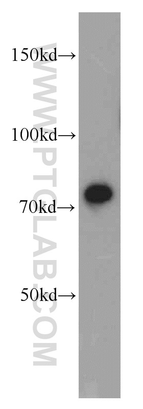Western Blot (WB) analysis of Y79 cells using Radixin Polyclonal antibody (13790-1-AP)