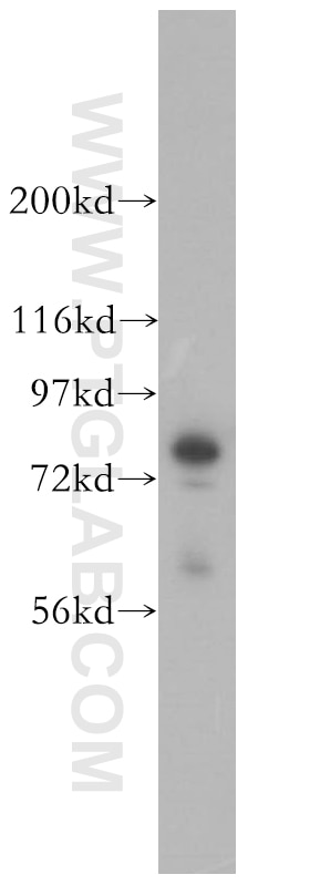 Western Blot (WB) analysis of mouse pancreas tissue using Radixin Polyclonal antibody (13790-1-AP)
