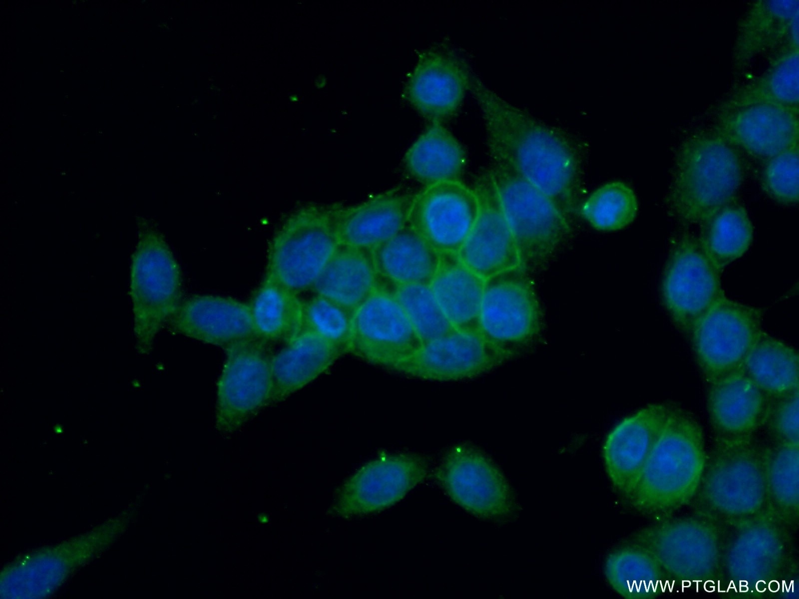 Immunofluorescence (IF) / fluorescent staining of HeLa cells using RDX Polyclonal antibody (26105-1-AP)
