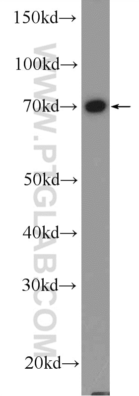 Western Blot (WB) analysis of HeLa cells using RDX Polyclonal antibody (26105-1-AP)