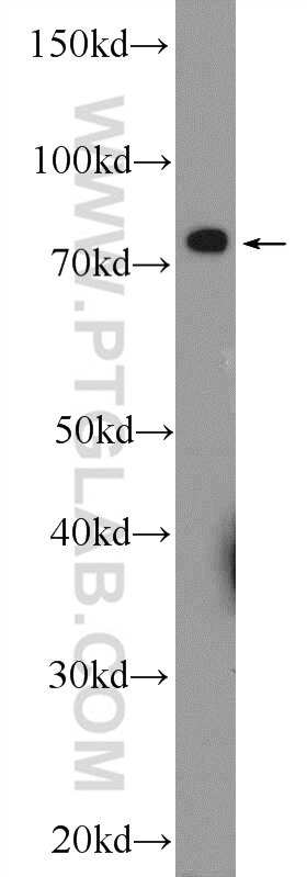Western Blot (WB) analysis of Jurkat cells using RDX Polyclonal antibody (26105-1-AP)