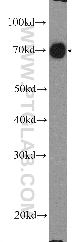 Western Blot (WB) analysis of mouse liver tissue using RDX Polyclonal antibody (26105-1-AP)