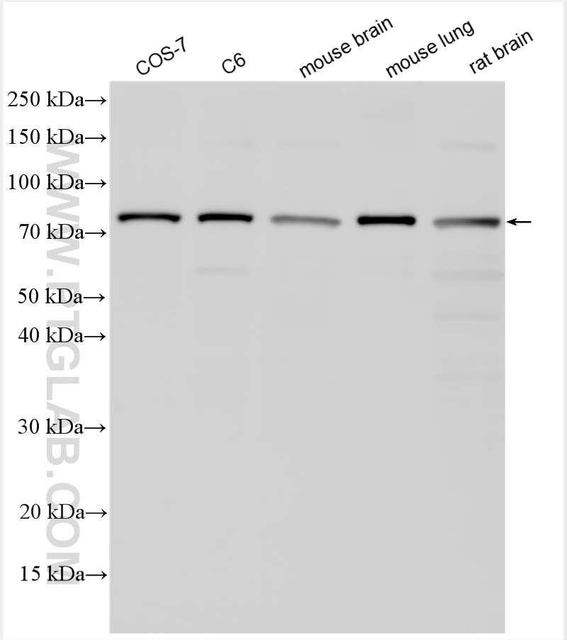 Western Blot (WB) analysis of various lysates using RDX Polyclonal antibody (26105-1-AP)