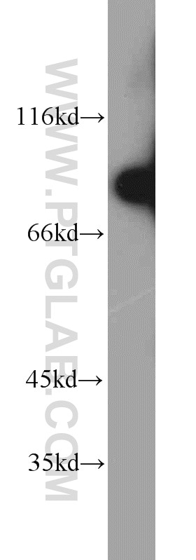 Western Blot (WB) analysis of human testis tissue using REC8 Polyclonal antibody (10793-1-AP)