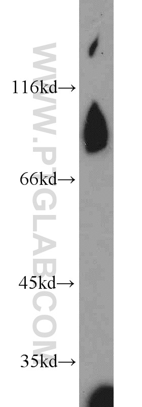 Western Blot (WB) analysis of human testis tissue using REC8 Polyclonal antibody (10793-1-AP)