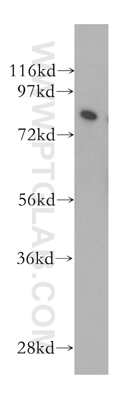 WB analysis of K-562 using 10793-1-AP