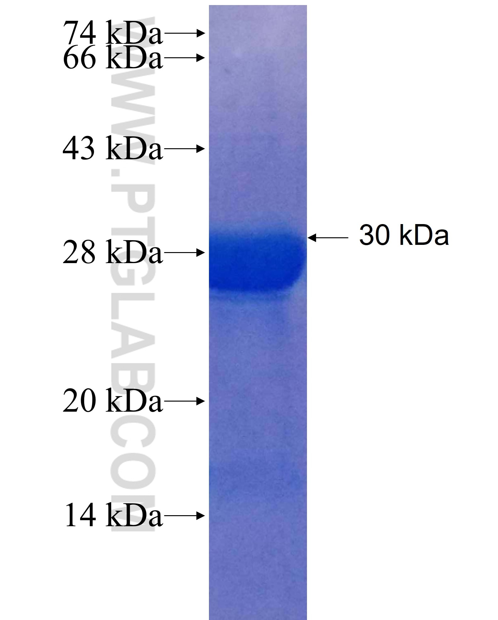 RECK fusion protein Ag25512 SDS-PAGE