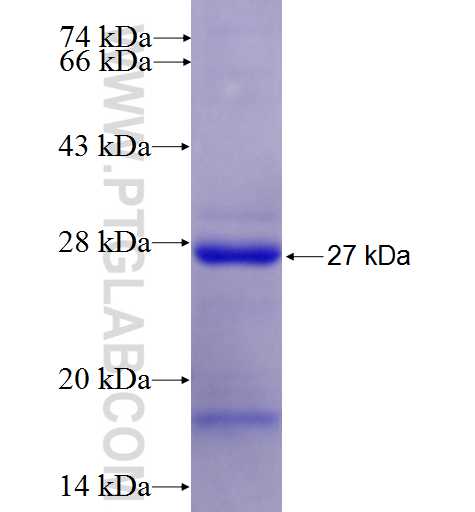 RECK fusion protein Ag5448 SDS-PAGE
