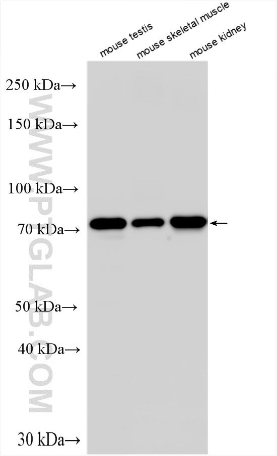 Western Blot (WB) analysis of various lysates using RECQL Polyclonal antibody (14940-1-AP)