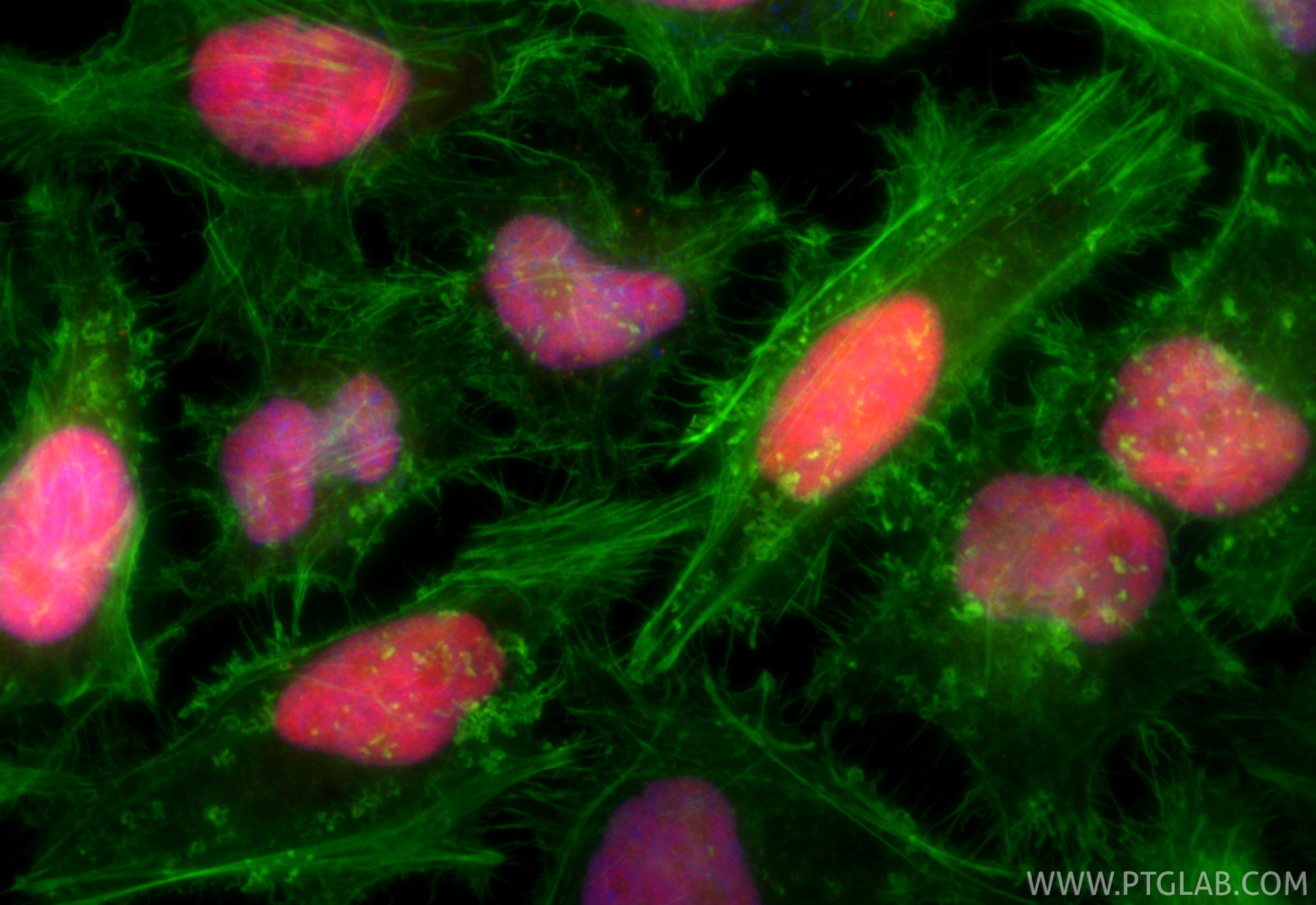 Immunofluorescence (IF) / fluorescent staining of HeLa cells using CoraLite®594-conjugated RECQL Recombinant antibody (CL594-85024-6)