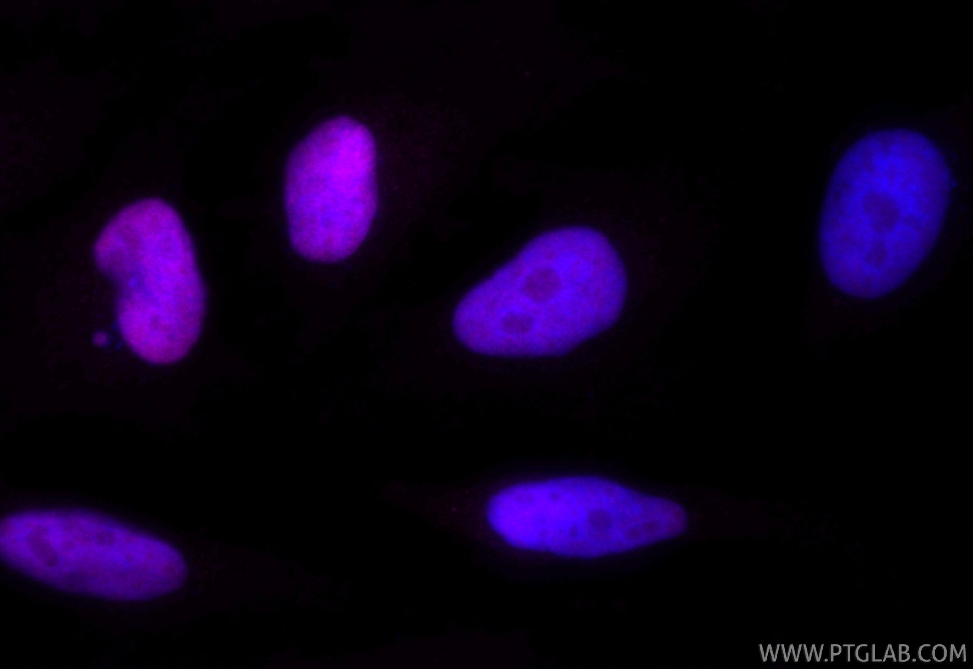 Immunofluorescence (IF) / fluorescent staining of HeLa cells using CoraLite® Plus 647-conjugated RECQL Recombinant an (CL647-85024-6)