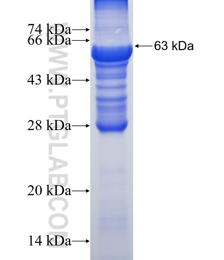 RECQL fusion protein Ag6834 SDS-PAGE
