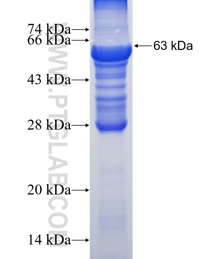 RECQL fusion protein Ag6834 SDS-PAGE