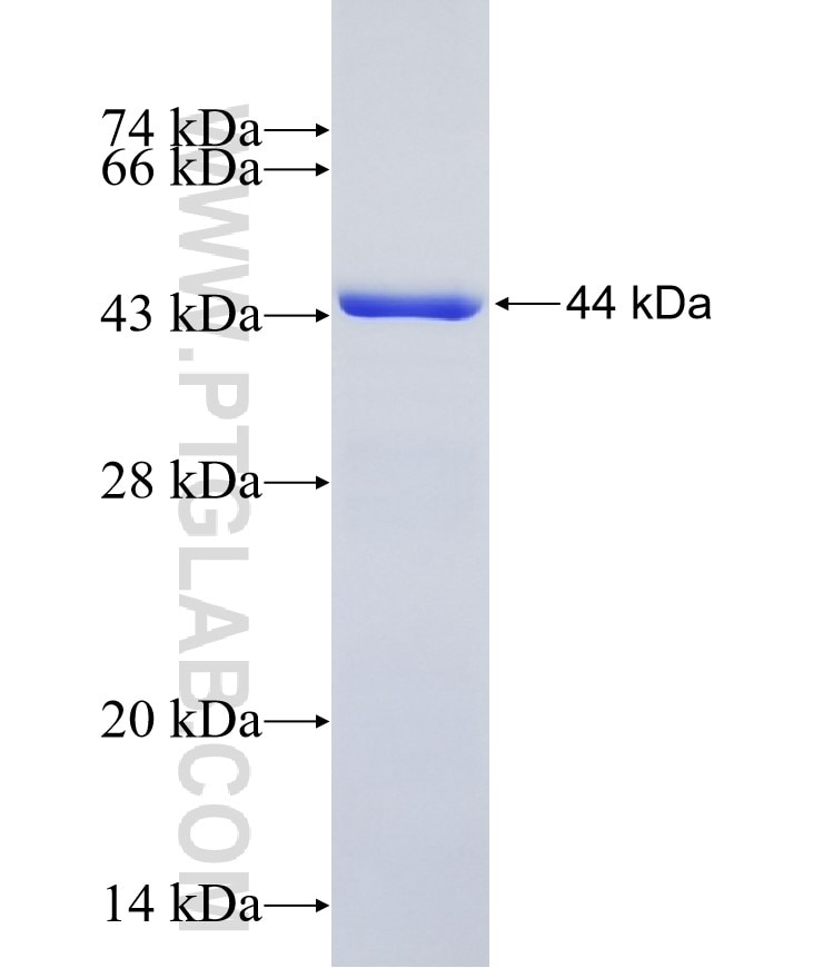 RECQL fusion protein Ag7121 SDS-PAGE