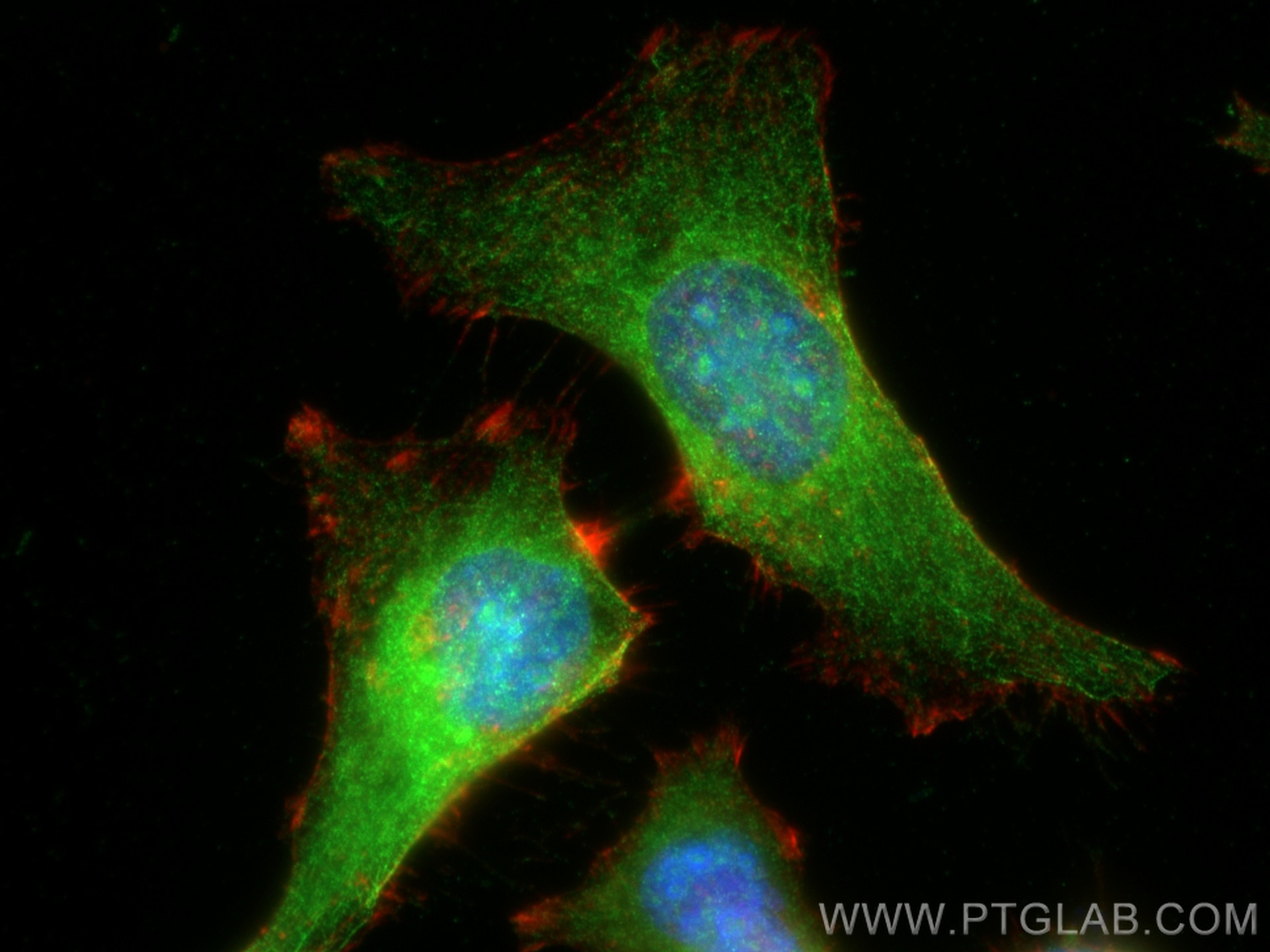 Immunofluorescence (IF) / fluorescent staining of HeLa cells using RECQL4 Polyclonal antibody (17008-1-AP)