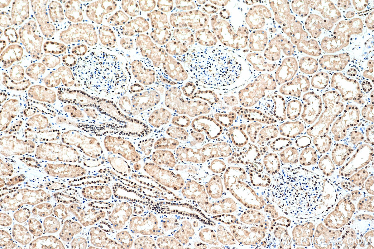 Immunohistochemistry (IHC) staining of human kidney tissue using RECQL4 Polyclonal antibody (17008-1-AP)