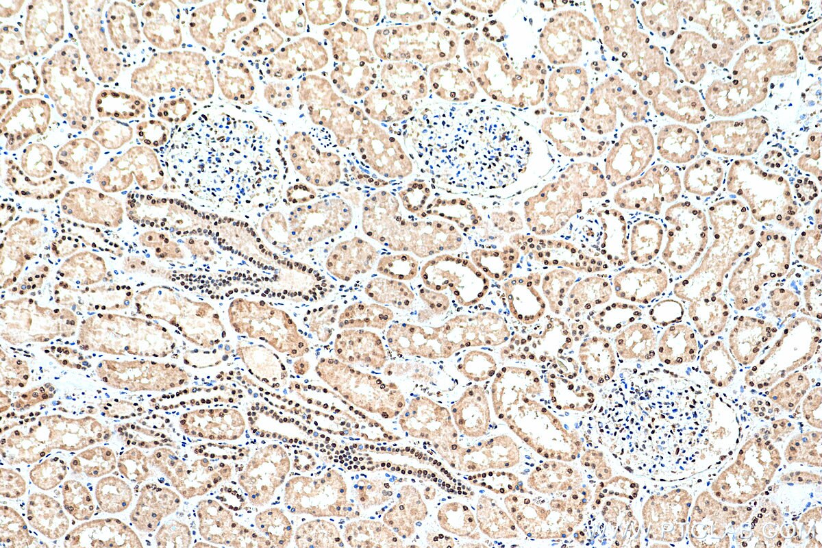 IHC staining of human kidney using 17008-1-AP