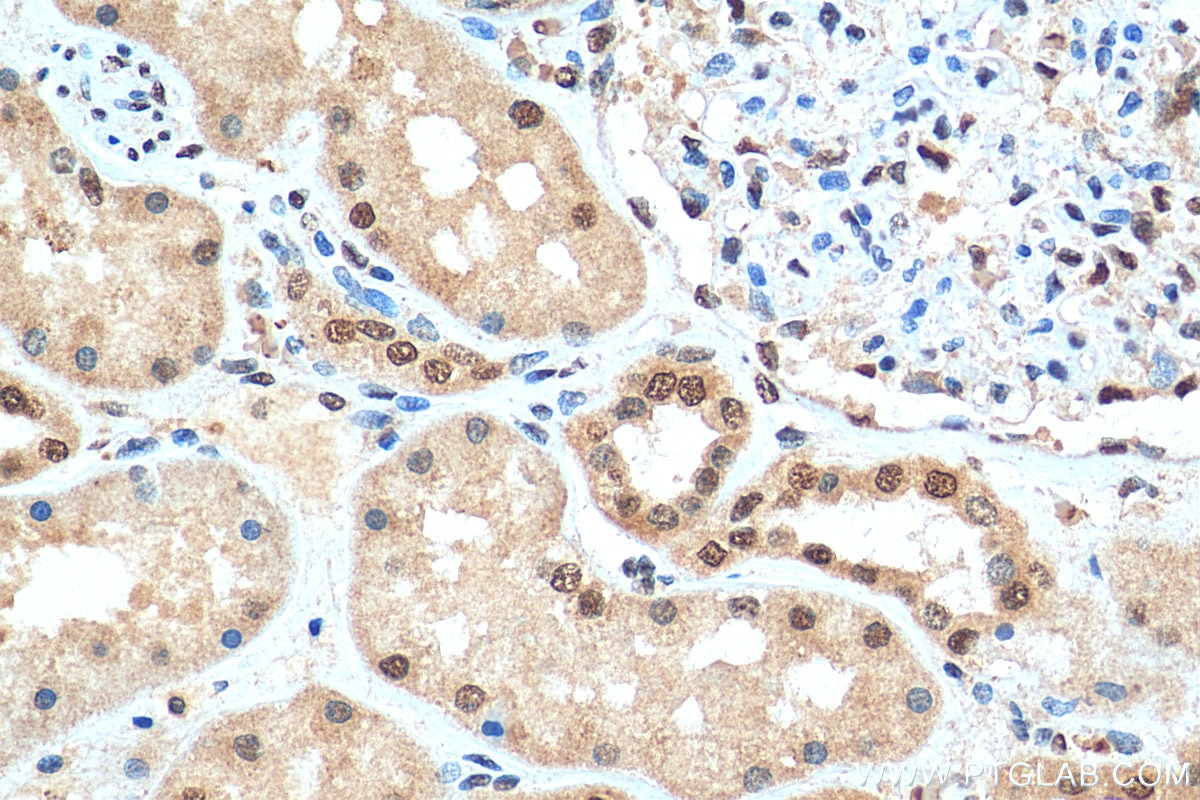 Immunohistochemistry (IHC) staining of human kidney tissue using RECQL4 Polyclonal antibody (17008-1-AP)