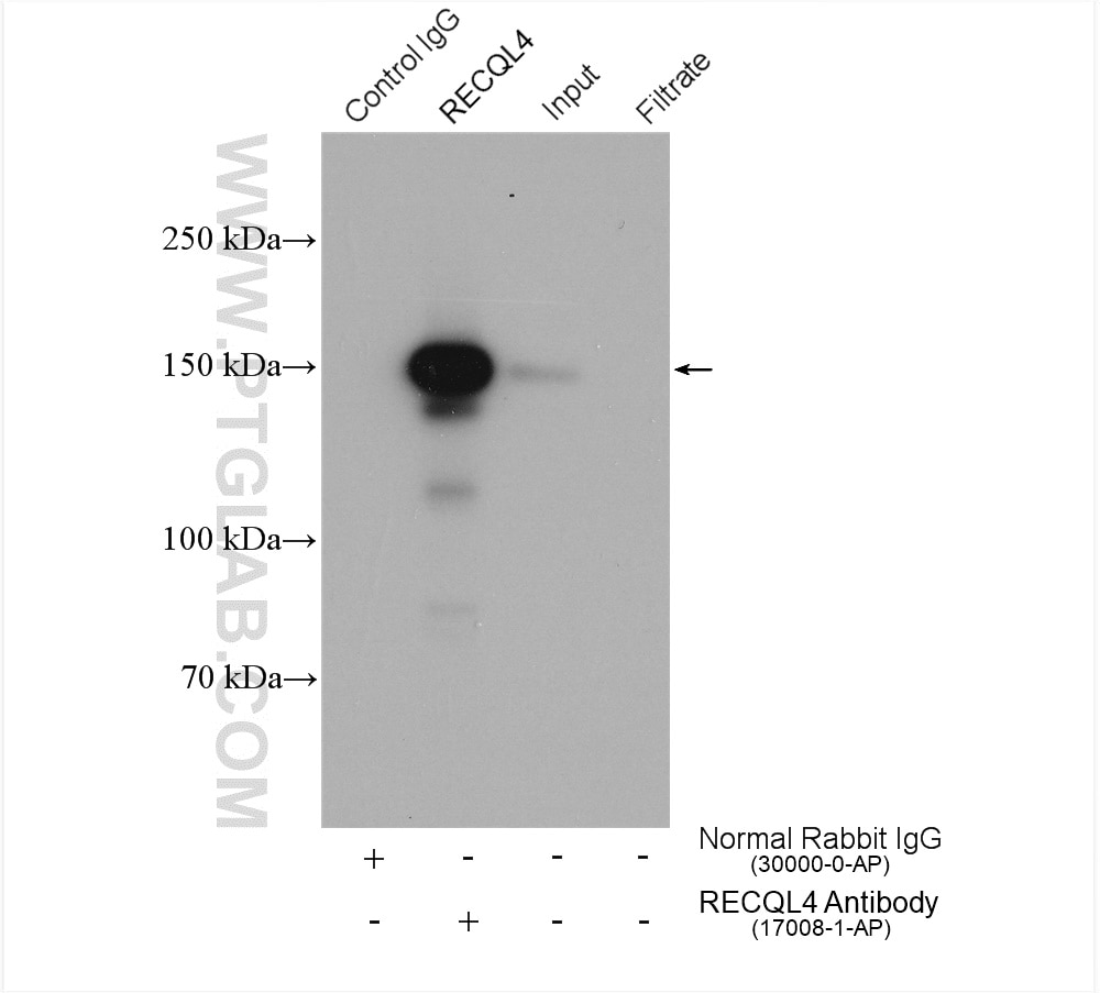 Immunoprecipitation (IP) experiment of HeLa cells using RECQL4 Polyclonal antibody (17008-1-AP)