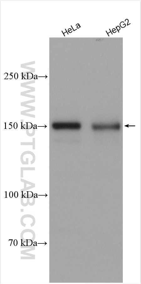 Western Blot (WB) analysis of various lysates using RECQL4 Polyclonal antibody (17008-1-AP)