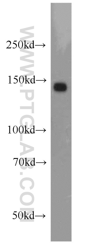 Western Blot (WB) analysis of HeLa cells using RECQL4 Polyclonal antibody (17008-1-AP)