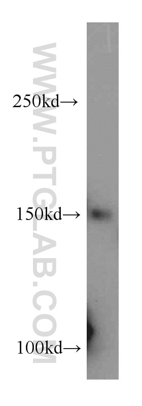 WB analysis of HeLa using 17008-1-AP