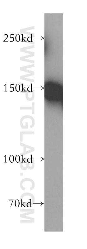 Western Blot (WB) analysis of HeLa cells using RECQL4 Polyclonal antibody (17008-1-AP)