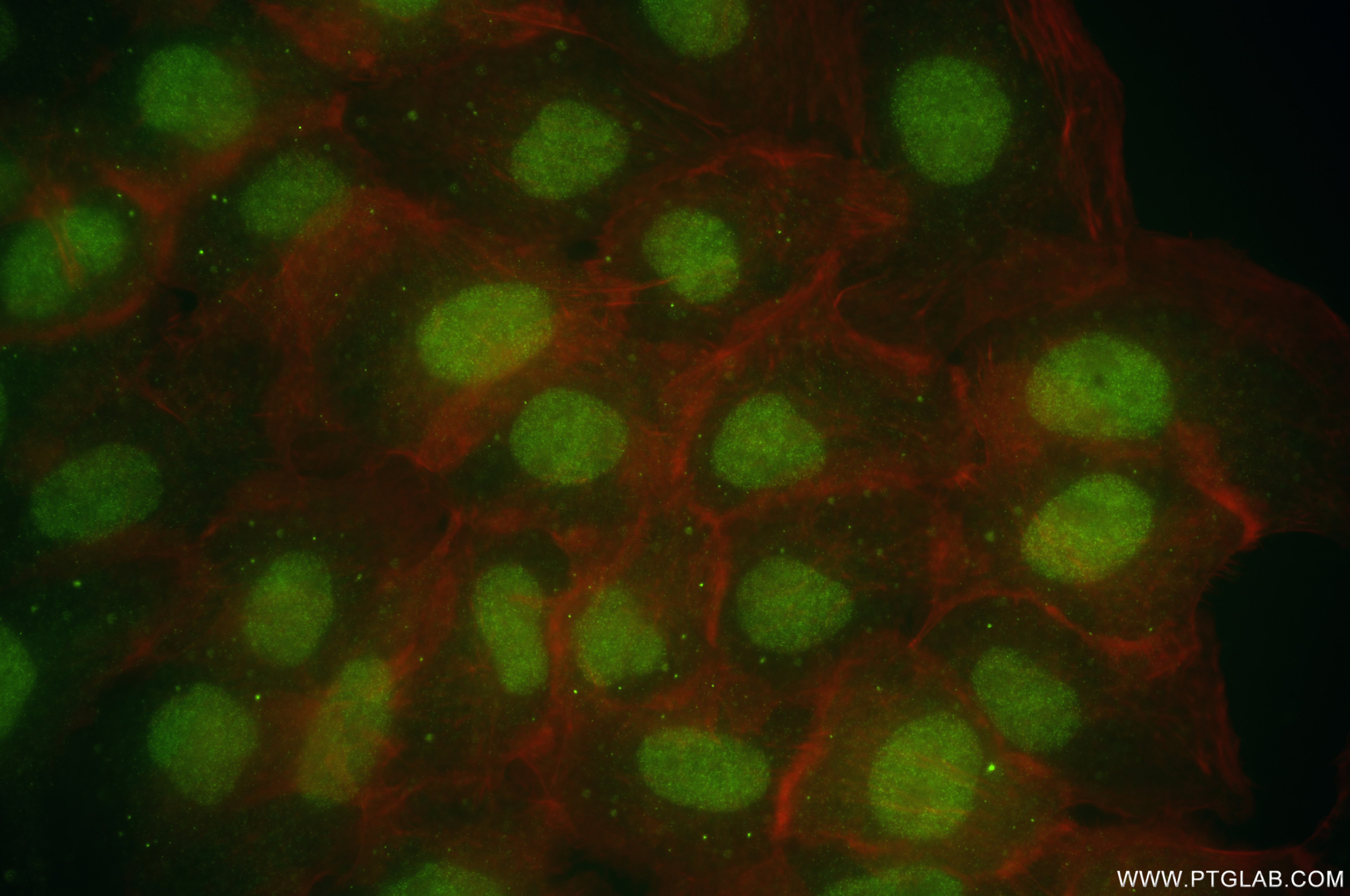 IF Staining of A431 using 86529-2-RR (same clone as 86529-2-PBS) Immunofluorescence (IF) / fluorescent staining of A431 cells using RECQL4 Recombinant monoclonal antibody (86529-2-RR)