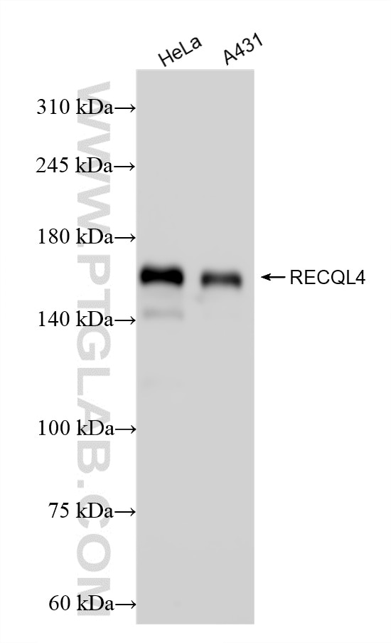 WB analysis using 86529-2-RR (same clone as 86529-2-PBS) Western Blot (WB) analysis of various lysates using RECQL4 Recombinant monoclonal antibody (86529-2-RR)