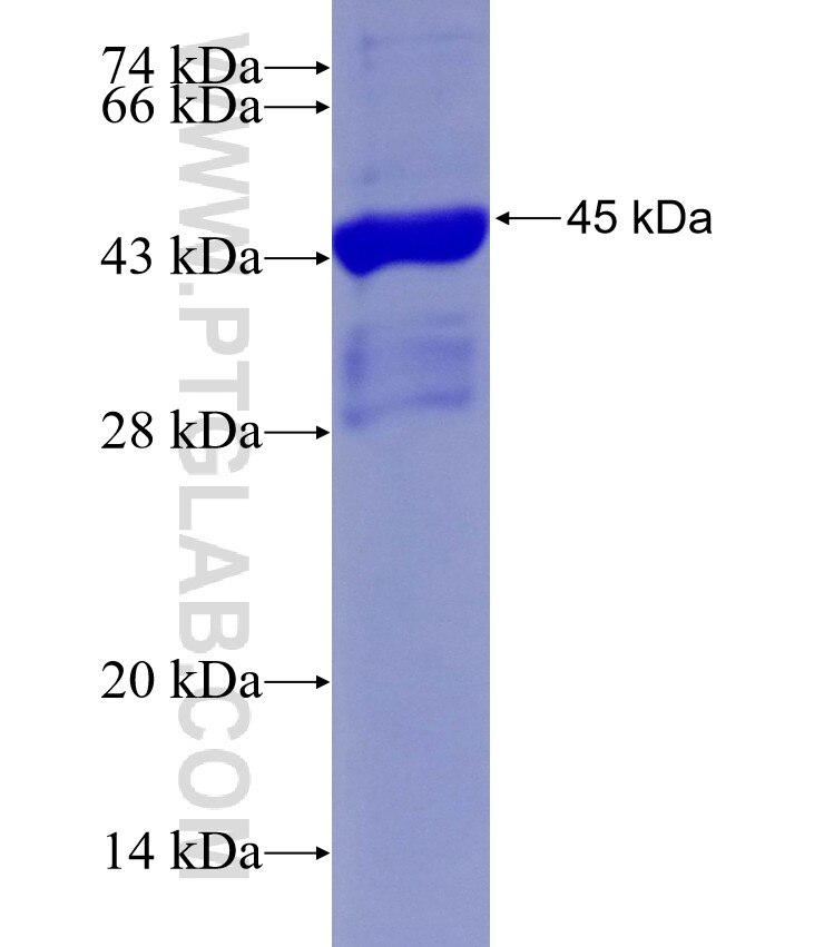 RECQL4 fusion protein Ag28742 SDS-PAGE