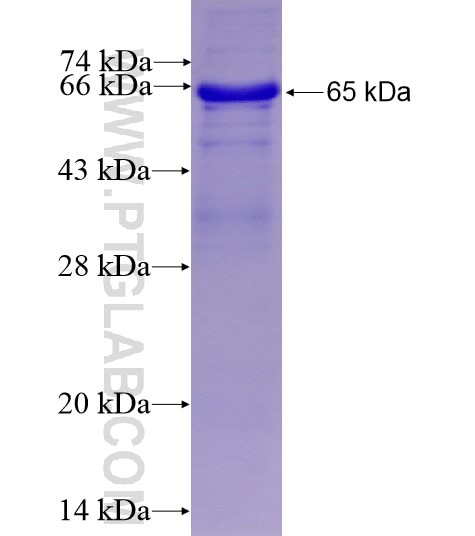 RECQL4 fusion protein Ag10707 SDS-PAGE