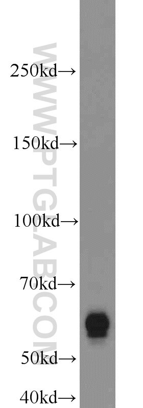 Western Blot (WB) analysis of mouse testis tissue using RECQL5 Polyclonal antibody (12468-2-AP)