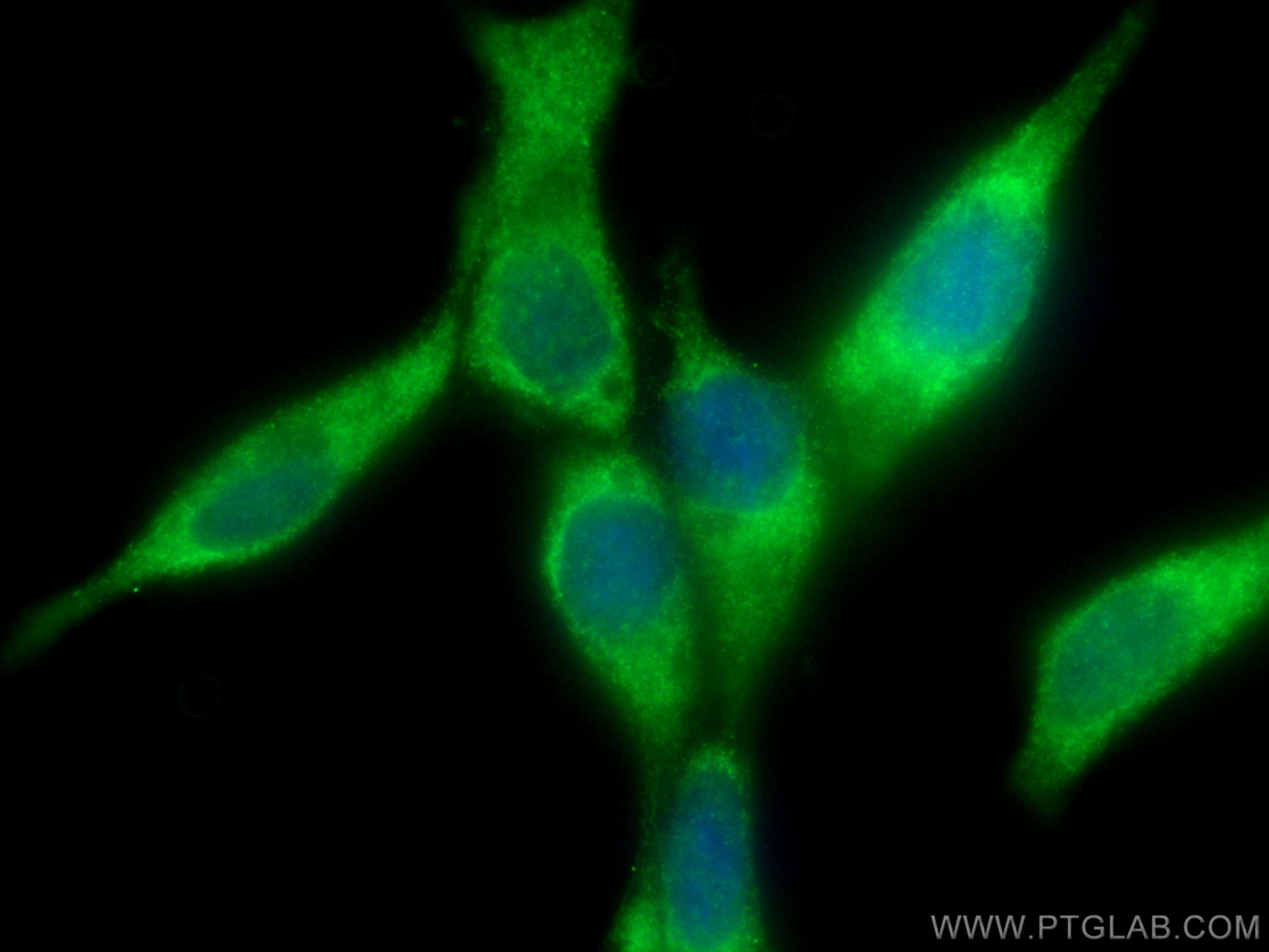 Immunofluorescence (IF) / fluorescent staining of LNCaP cells using REDD1 specific Polyclonal antibody (10638-1-AP)