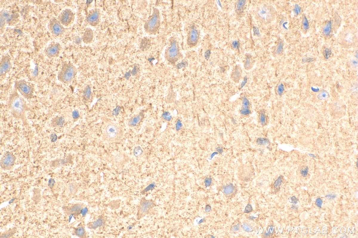 Immunohistochemistry (IHC) staining of mouse brain tissue using REDD1 specific Polyclonal antibody (10638-1-AP)