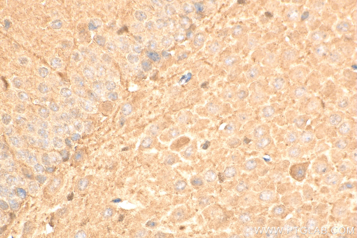 Immunohistochemistry (IHC) staining of mouse brain tissue using REDD1 specific Polyclonal antibody (10638-1-AP)