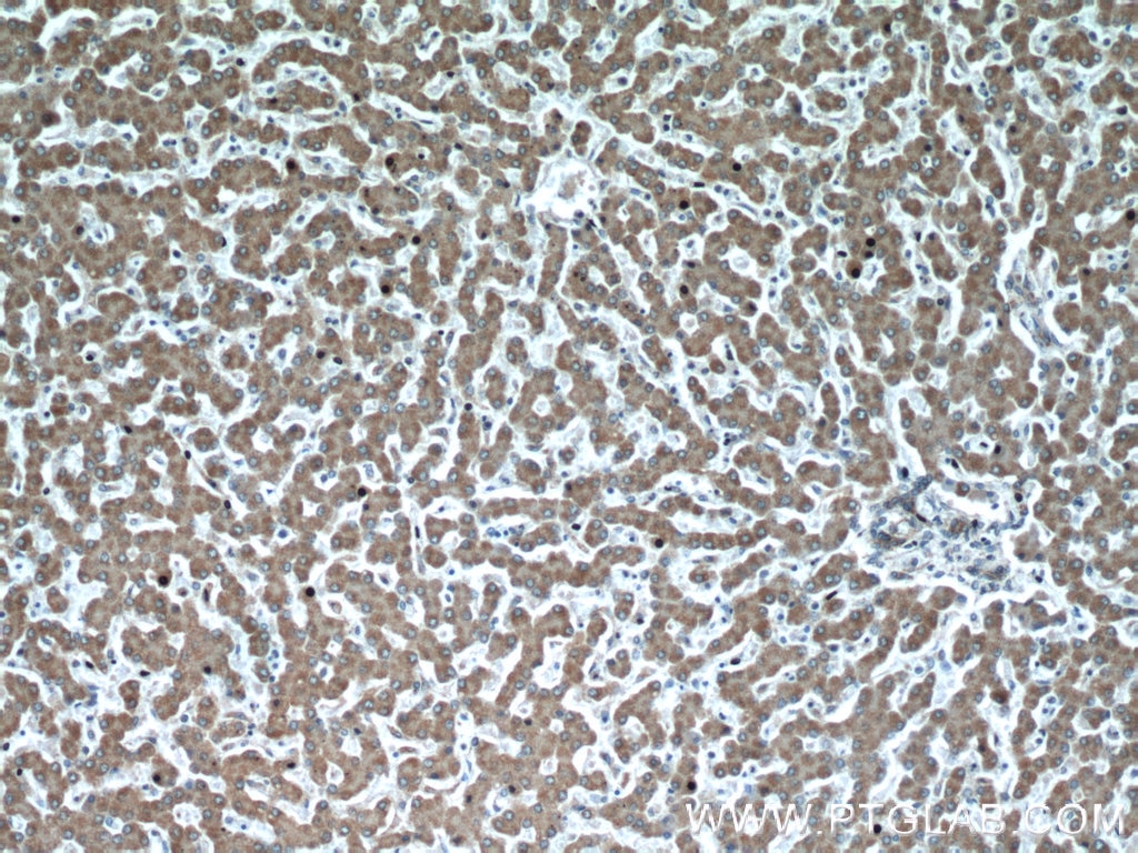 Immunohistochemistry (IHC) staining of human liver tissue using REDD1 specific Polyclonal antibody (10638-1-AP)