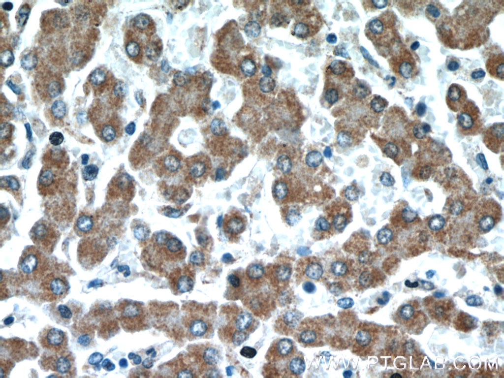 Immunohistochemistry (IHC) staining of human liver tissue using REDD1 specific Polyclonal antibody (10638-1-AP)