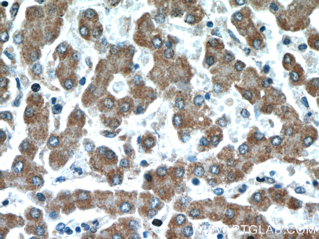 IHC staining of human liver using 10638-1-AP