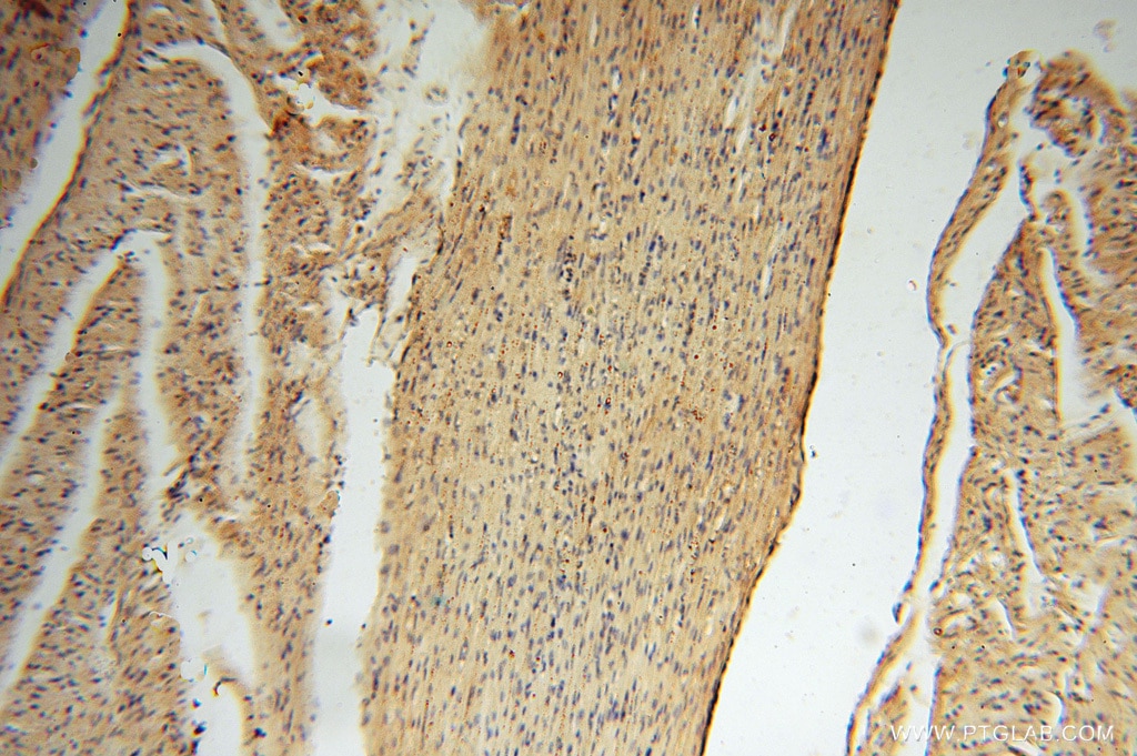 IHC staining of human heart using 10638-1-AP