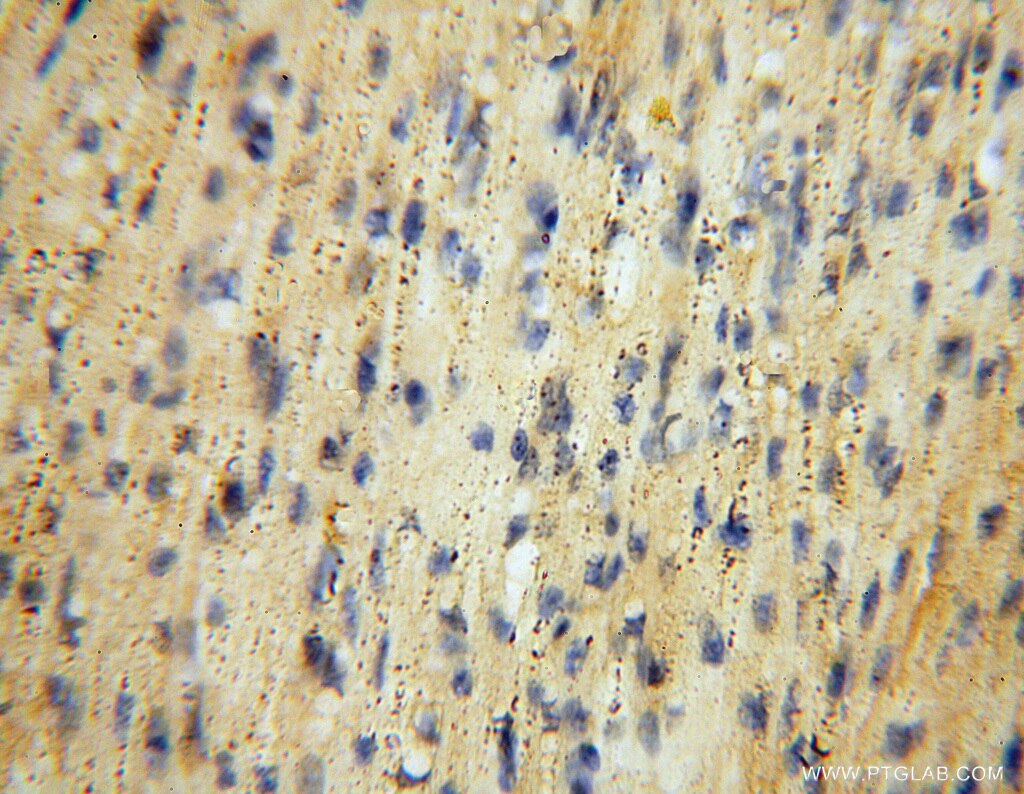 Immunohistochemistry (IHC) staining of human heart tissue using REDD1 specific Polyclonal antibody (10638-1-AP)