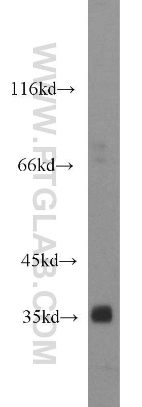 Western Blot (WB) analysis of DU 145 cells using REDD1 specific Polyclonal antibody (10638-1-AP)