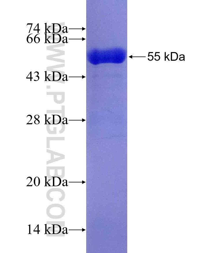 REDD1 fusion protein Ag0965 SDS-PAGE