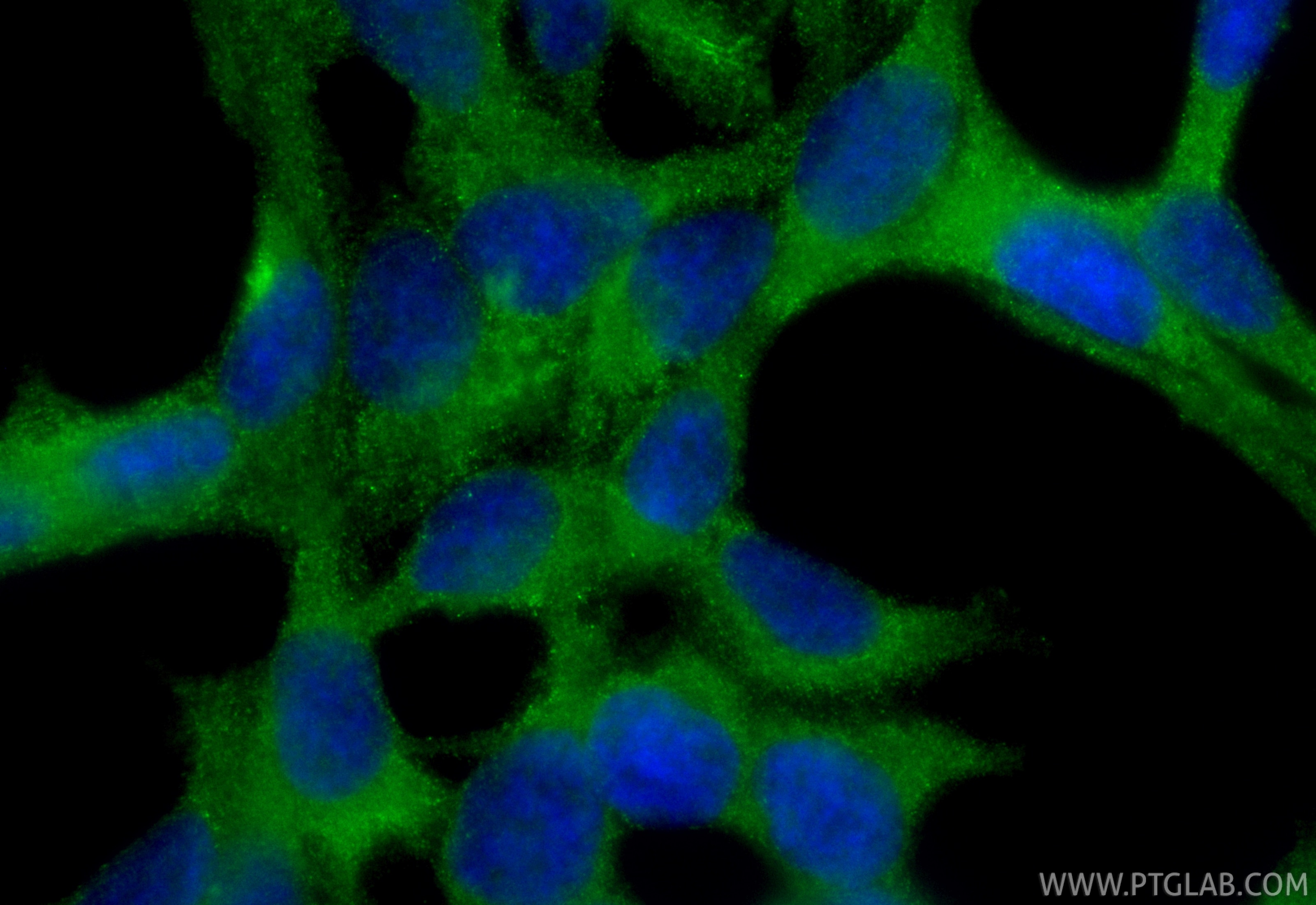 Immunofluorescence (IF) / fluorescent staining of LNCaP cells using CoraLite® Plus 488-conjugated REDD1 specific Polyc (CL488-10638)