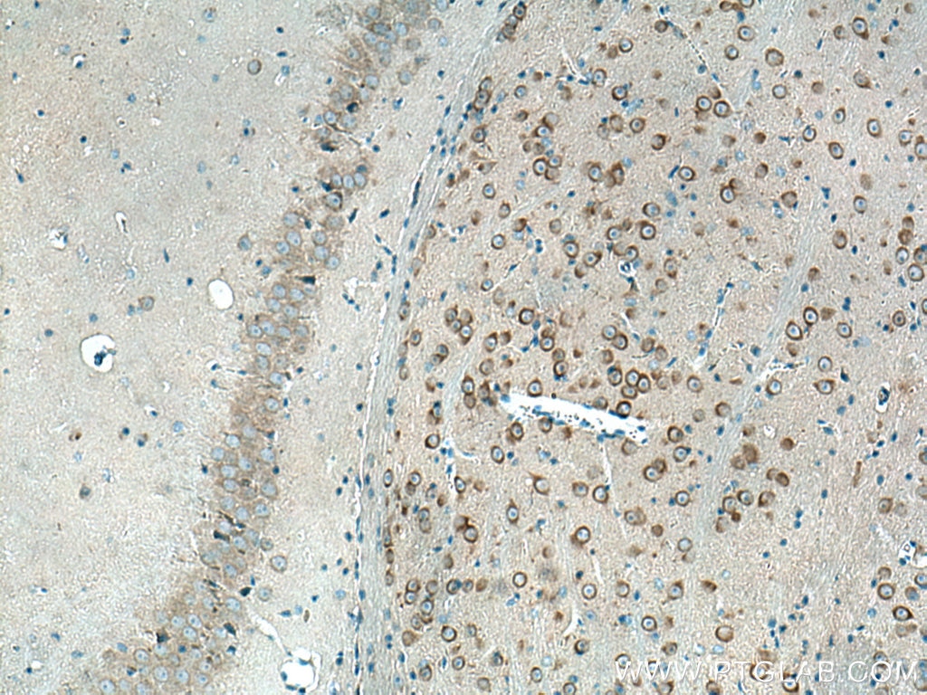 Immunohistochemistry (IHC) staining of mouse brain tissue using REEP1 Polyclonal antibody (17988-1-AP)