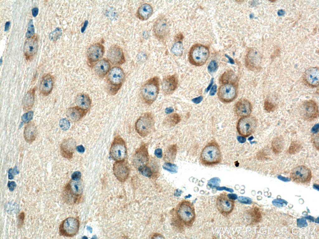 Immunohistochemistry (IHC) staining of mouse brain tissue using REEP1 Polyclonal antibody (17988-1-AP)