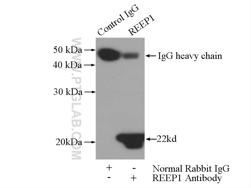 Immunoprecipitation (IP) experiment of mouse brain tissue using REEP1 Polyclonal antibody (17988-1-AP)