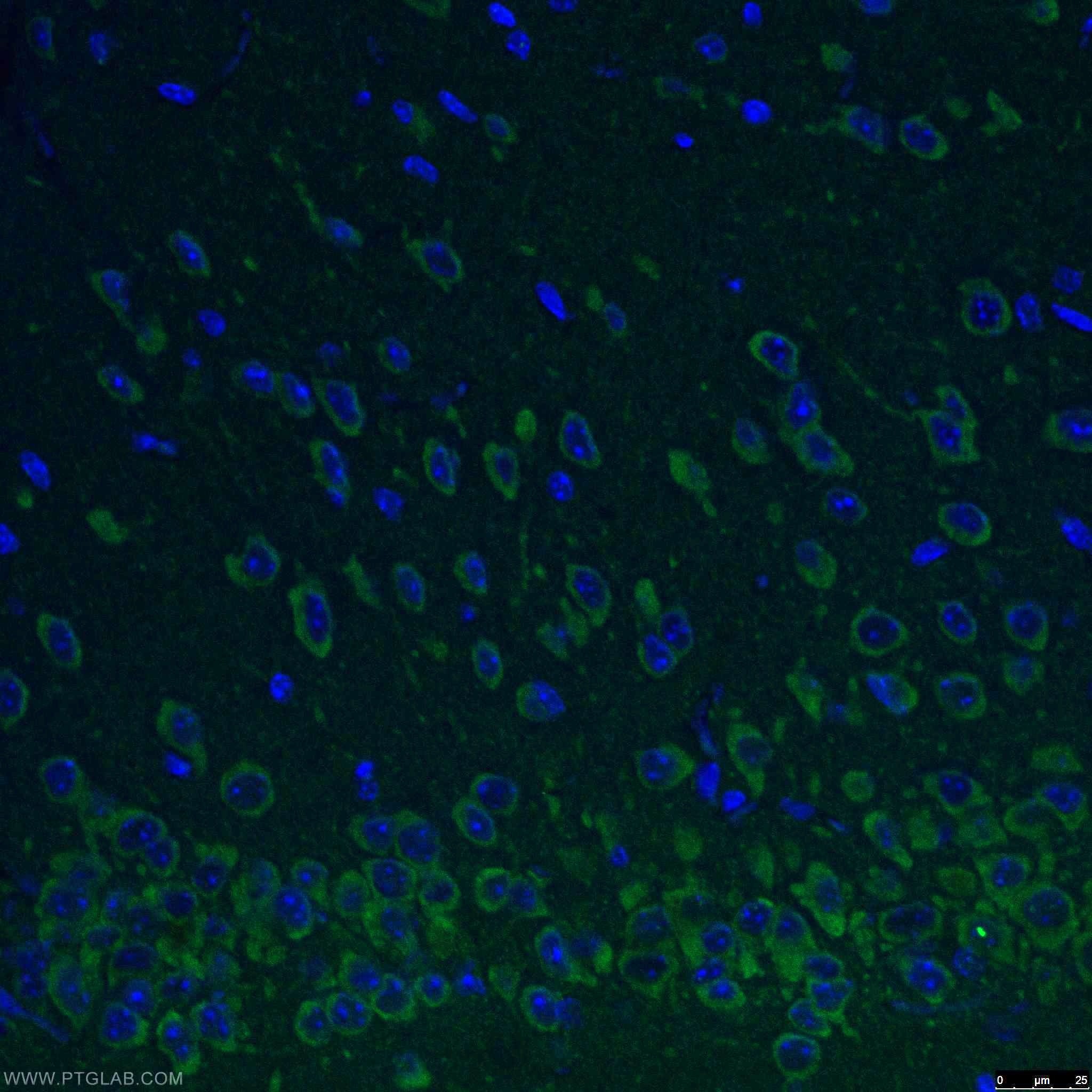 Immunofluorescence (IF) / fluorescent staining of mouse brain tissue using REEP2 Polyclonal antibody (15684-1-AP)
