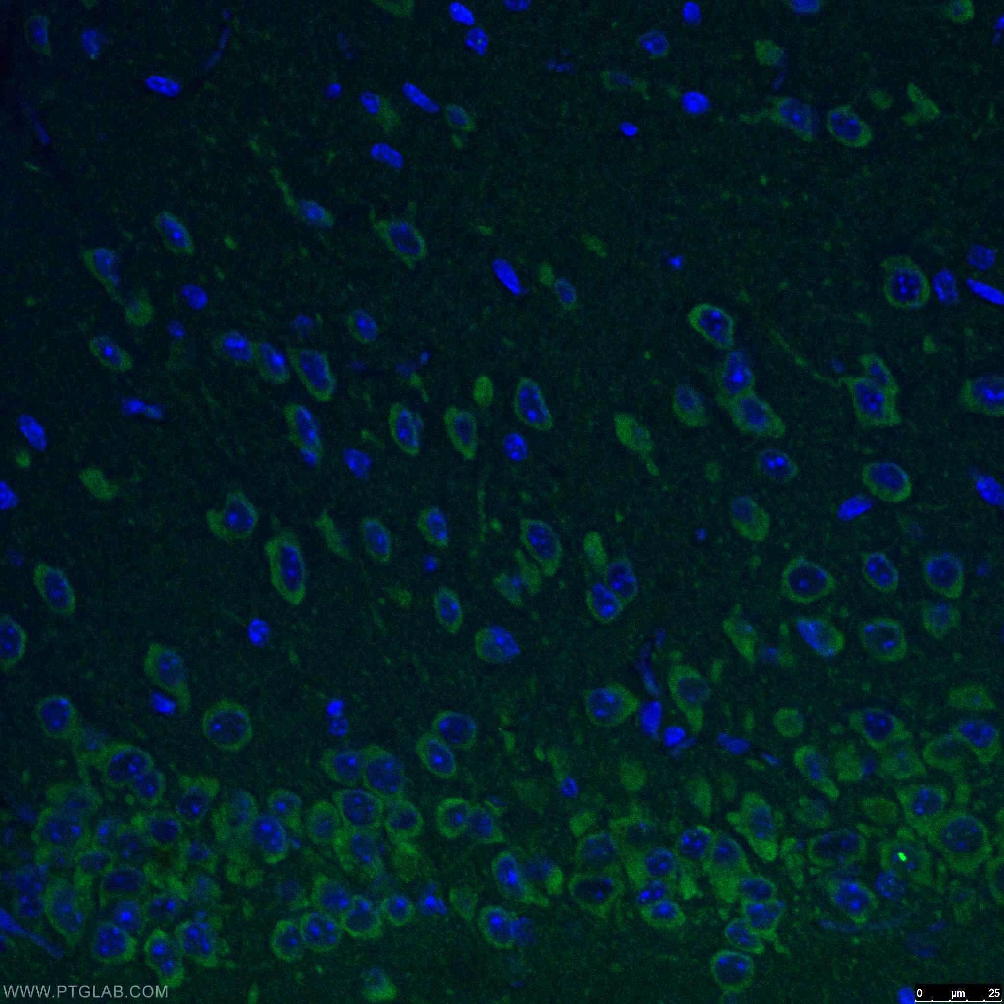 Immunofluorescence (IF) / fluorescent staining of mouse brain tissue using REEP2 Polyclonal antibody (15684-1-AP)